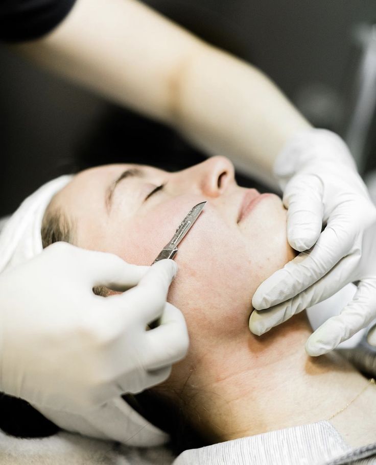 GLOWDermaplaning